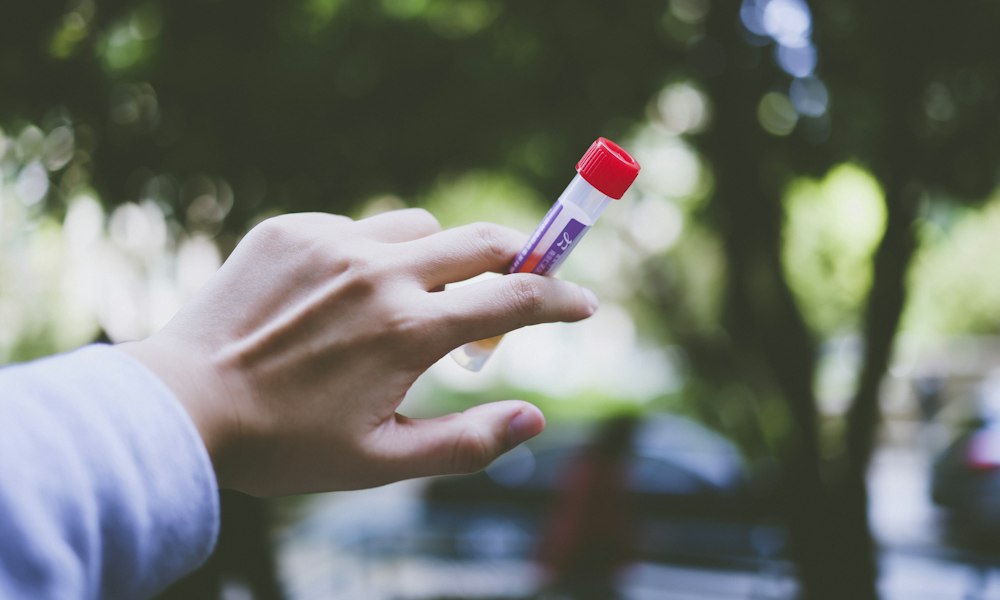 Begleitfoto zum Beitrag: Testosteron-Enantat: Wirkung, Anwendung und Risiken