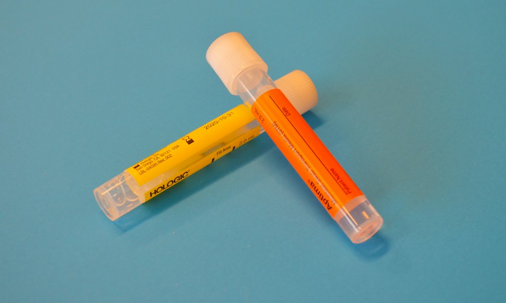 Begleitfoto zum Beitrag: Trenbolonacetat und die körpereigene Testosteronproduktion